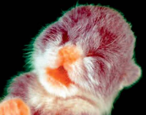 Neonatale erytrolyse